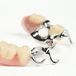 歯の欠損に対する補綴治療（入れ歯・ブリッジ）